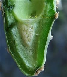  Hypanthium V.S. with inferior ovary